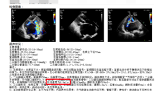 警惕！这种风湿病可致命！