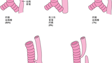 宝宝喝不进奶、吃不下饭，全因这个先天疾病......
