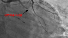 【附属国际壮医医院】速度！31分钟开通“生命之路”